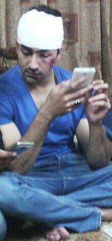 Hammad Farooqui Had Got An Accident Last Week