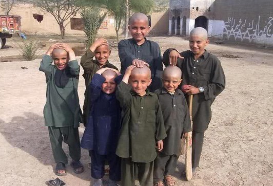 Kids Goes Bald Like a BOSS!!