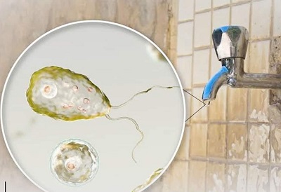 7th Case Of Naegleria Fowleri Reported In Karachi